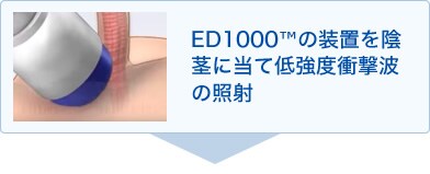 ED1000治療 画像01