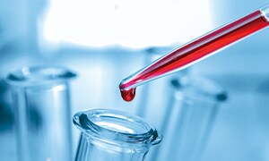 ミアテスト乳がん