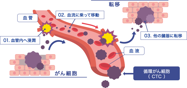 循環がん細胞（CTC）イメージ