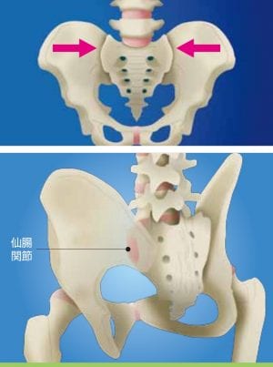慢性腰痛症の原因が仙腸関節障害の場合 墨田区両国のsbc湘南メディカル記念 病院