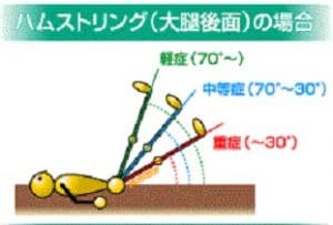 ハムストリング損傷 太もも裏側 スポーツ障害 墨田区両国のsbc湘南メディカル記念 病院